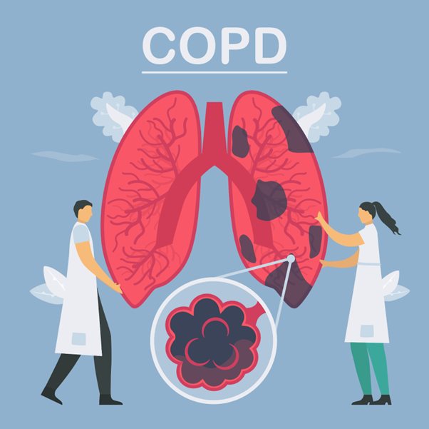 COPD causing airflow obstruction and breathing difficulties in the lungs
