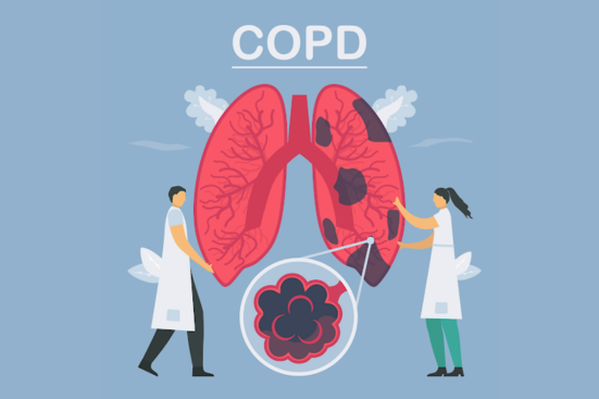 Doctors examining and treating COPD lungs